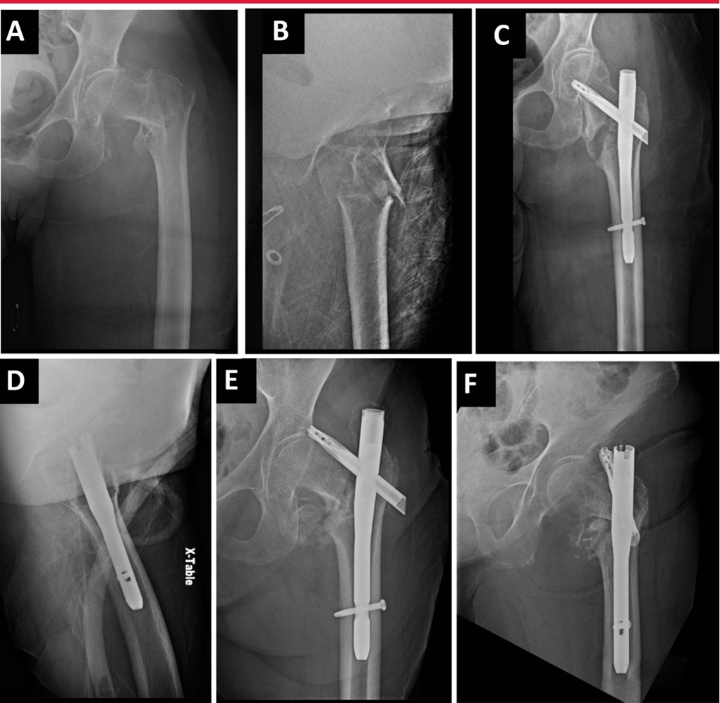 1702007682239188.jpg 12.jpg